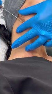 Skin Transformation @Puar.Medspa in Lake Mary. #Shorts