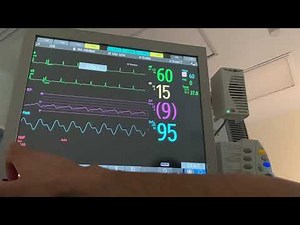 Cardiac Monitoring