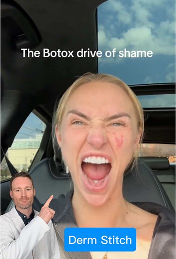 Boost Botox Longevity with Facial Exercises