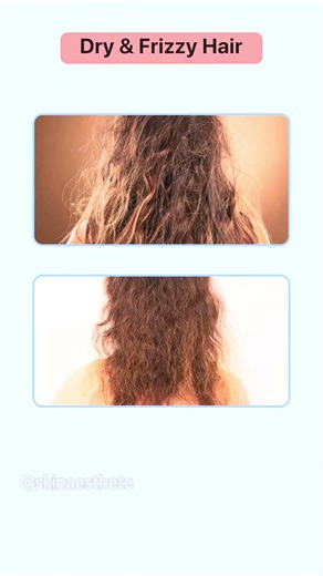 The best shampoos for every hair type 👇#hairfall #dandruff #colouredhair#haircare #shampoo#hair