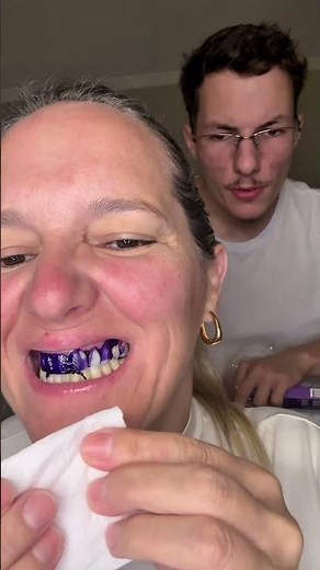Fita Clareadora Dental Roxa! MINHA MÃE USOU #shots