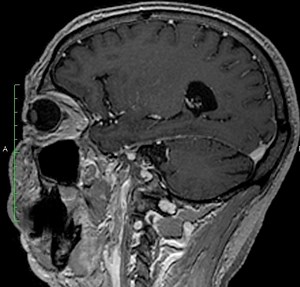 Choosing the Best Medical Imaging Scan to Create a 3D Printed Medical Model