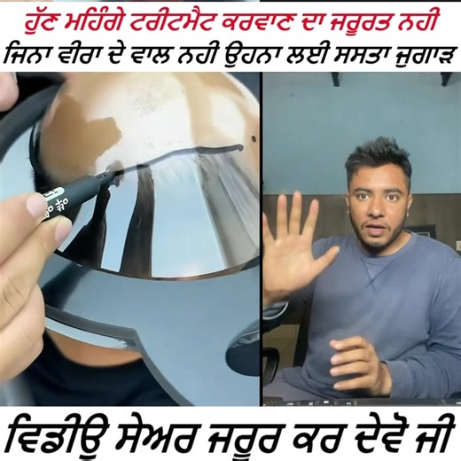 627K views · 10K reactions | ਜਿੰਨਾ ਕੋਲ ਸਿਰ ਦੇ ਵਾਲ ਲਗਵਾਉਣ ਲਈ ਪੈਸੇ ਨਹੀਂ ਉਹ ਵੀਰ ਆਹ ਦੇਸੀ ਜੁਗਾੜ ਵਰਤੋ ਘੱਟ ਖ਼ਰਚੇ ਵਿੱਚ ਗੰਜਾਪਣ ਦੂਰ ਕਰੋ  | ਦੇਸੀ ਤਰੀਕੇ | Facebook