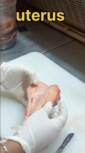 Uterus specimen cutting✂️🛑| #histopathology #cervicaltreatment #histomuseum #uterineprolapse #uterus