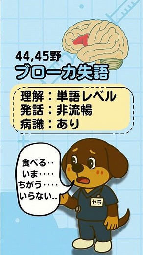 【疾患解説】ブローカ失語/ウェルニッケ失語とは？ #失語 #リハ #作業療法 #理学療法 ＃言語聴覚療法