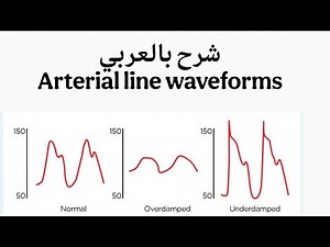 شرح ال arterial line waveforms بالعربي overdamped and underdamped