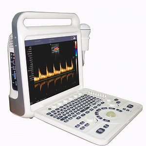 [Hot Item] Portable Color Ultrasound Machine Ecografo for Medical