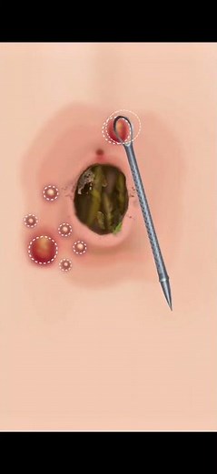 Extreme Belly Button Cleaning 4K ASMR Animation