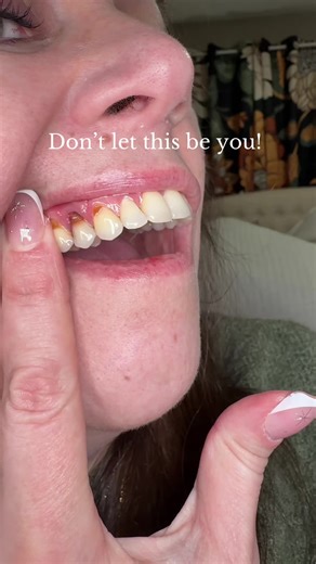 Hydroxyapatite Toothpaste for Better Oral Health