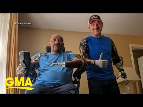 Worker who lost arms on the job inspires others