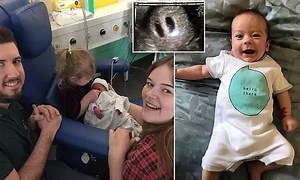 Heartbreaking decision! Couple expecting triplets forced to sacrifice conjoined twins to save one