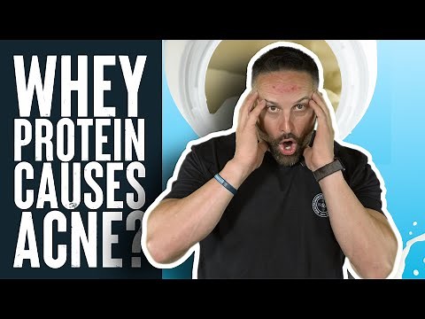 Whey Protein Causes Acne? | Educational Video | Biolayne