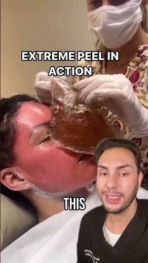 ONE treatment, gets rid of WRINKLES, SCARS, EVERYTHING!