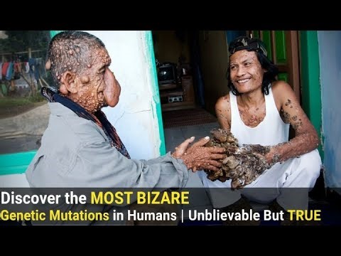 Discover the MOST BIZARRE Genetic Mutations in Humans