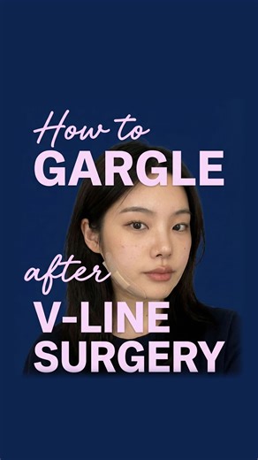 id Plastic Surgery Hospital on Instagram: "Hi, I’m Alexa 👋 I had my surgery at id Hospital, and today I’m going to show you how to gargle properly after surgery. 🧴 What you need - Hexidine 20ml - Saline solution - Gargle cup 🌀 How to gargle 1️⃣ Mix 20ml of Hexidine into the saline solution 2️⃣ Shake well and pour it into your gargle cup 3️⃣ Gargle 10 swishes per round, repeat 10 times 4️⃣ Spit everything out and make sure nothing is left in your mouth 👄 Helpful tips - If you can’t fully clos