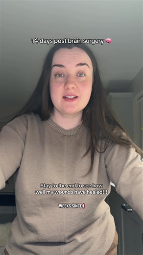 14 Days After Brain Surgery: Healing Journey