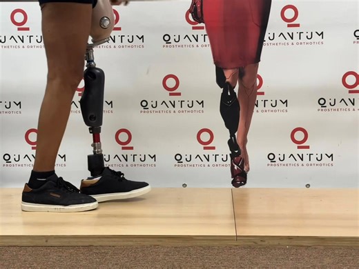 💪🦿 Strength in Every Step Today, our AK patient is training with his finalized prosthesis and microprocessor knee — building confidence and refining his gait between the parallel bars. Incredible progress! #MobilityMatters #QuantumPO #ProstheticsThatInspire #QuantumPO #UpperLimbProsthetics #Teamwork #PositiveMindset #NoLimits #ProstheticsThatInspire #QuantumPO #PatientInspiration #everyonehighlightsfollowers #prostheticsthatinspire #ProstheticsCare #QuantumProsthetics #Quantumclinics #belowkne