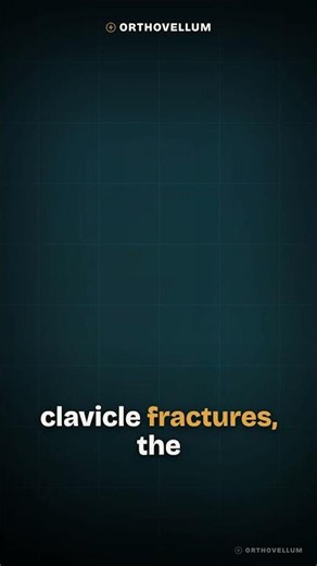 Clavicle Fractures Masterclass | Orthopaedic Teaching