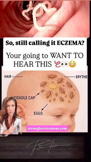 5.3K views · 54 reactions | ‼️What if it’s not “just eczema, ⚠️ but...