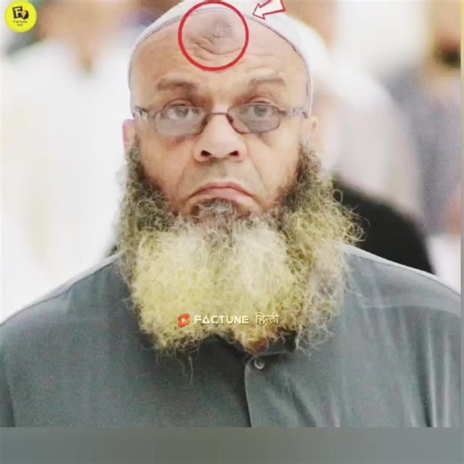 Understanding the Significance of Forehead Sajda Mark