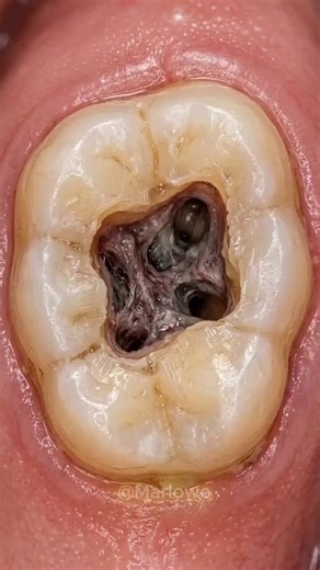 But what’s the name of this disease?