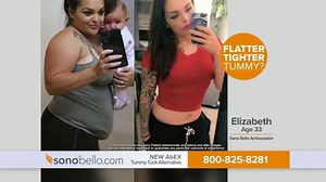 Sono Bello AbEX TV Spot, 'Tummy Tuck Alternative: $250 Off'