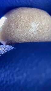 #bubblebags #bubblehash #fullmelthash | Terpy Dave Dauphin