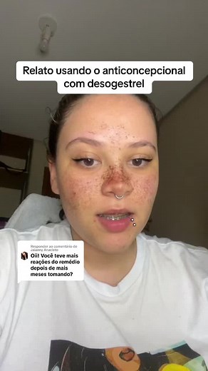 Anticoncepcional Desogestrel: Relatos e Efeitos Colaterais