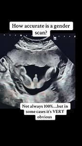 via echoexpert/tt | Nursesproud