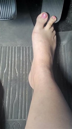 Sparkly Pink Toenails For Winter #winter