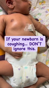 100K views · 596 reactions | Newborn coughing is something parents...