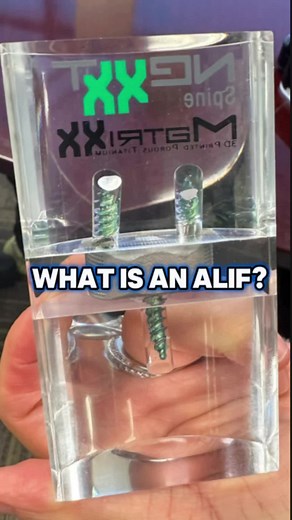 Let’s talk about ALIF – anterior lumbar interbody fusion. 🦴 This is a surgical approach that removes a damaged disc and fuse the vertebrae. The benefit of ALIF is that it allows me to preserve key back muscles and nerves while still providing stability to the spine. 💪 It’s an effective option for patients with certain spine conditions, helping to relieve pain and restore function. #ALIF #SharifSpine #SpineSurgery #SpineSpecialist #BackPainRelief #SciaticaTreatment #SpineHealth #SpineCare #Spin