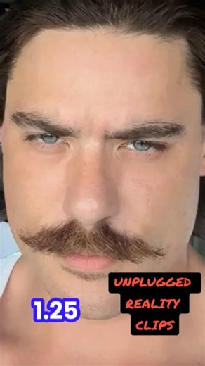 Chud, the builder's bond has been set to 1.25 mil, and the victim Joshua fox is in stable condition