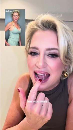 Dorinda Medley's Secret to Staying Snatched at 60: Sono Bello One Visit Fat Removal