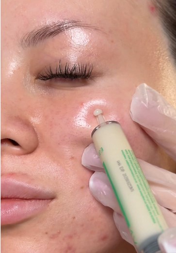 Repair Dull Skin with Easydew DW-EGF Melatoning Ampoule