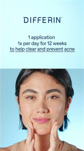 Treat Acne with Differin Retinoid Adapalene Gel