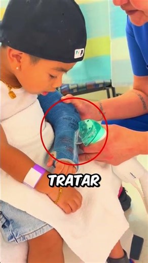 He Was Scared to Remove His Cast Until the Doctor Calmed Him Down 🥹❤️