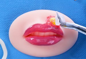 18K views · 18 reactions | How common surgical procedures are performed: | 5-Minute Workouts | Facebook