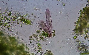 纤毛虫交配 Sexual Reproduction in Ciliates - Blepharisma Conjugation