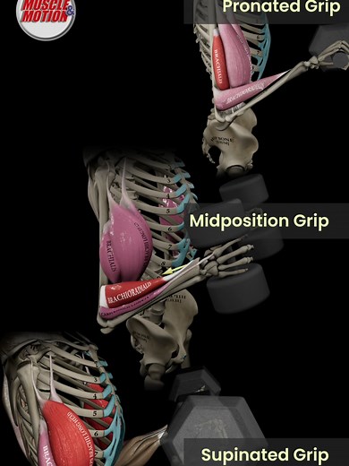 Understanding Supinated, Mid, and Pronated Curls