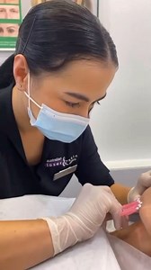 1K views | PDO threads can treat the following areas: Cheeks Jawline...