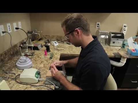 How We Make Dentures | All In One Dental | 8/26/2016