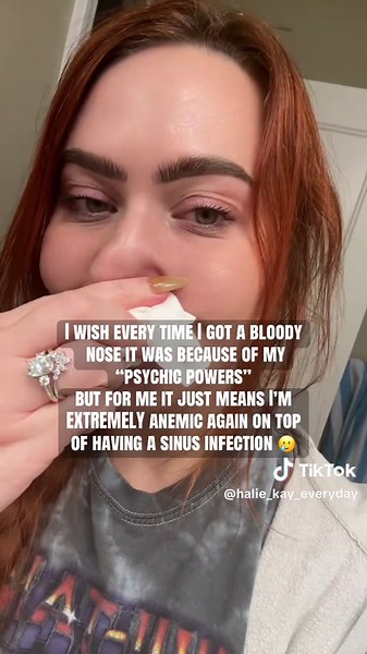 Bloody noses in real life aren’t as cool as in Stranger Things 🥲 #strangerthings #strangerthings5 #eleven