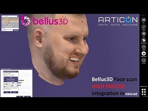 Bellus3D Face scan HIGH PRECISE integration in Exocad