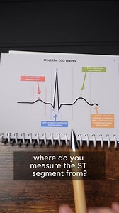 3.6K views · 36 reactions | Where do you measure the ST segment from?  If you’re interested in the featured ECG pocketbook head to my link tree Educational purposes only  | Pocket Paramedic | Facebook