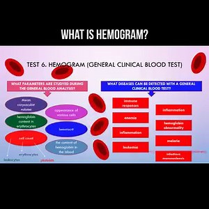 What is hemogram? The hemogram consists in the analysis of all blood cells, as well as the average volume of erythrocytes, the appearance of various cells, the hemoglobin content in erythrocytes, the ratio of the volume of erythrocytes to the total blood volume (hematocrit), cell count, hemoglobin content in the blood. During this analysis, the number of such blood cells is established: erythrocytes, leukocytes, platelets. The analysis reveals such disorders as: immune reactions, inflammation, a
