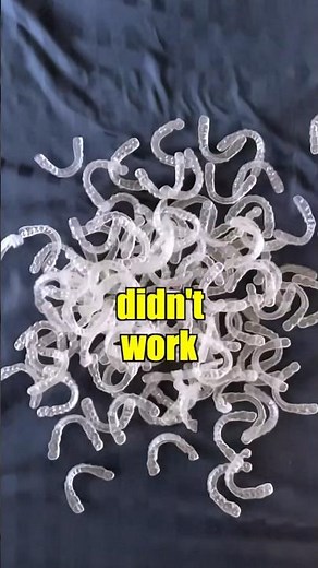 Invisalign Was A Disaster