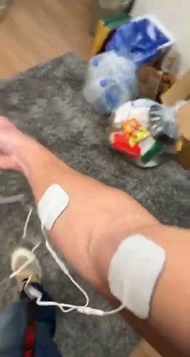 My first time using a Tens unit