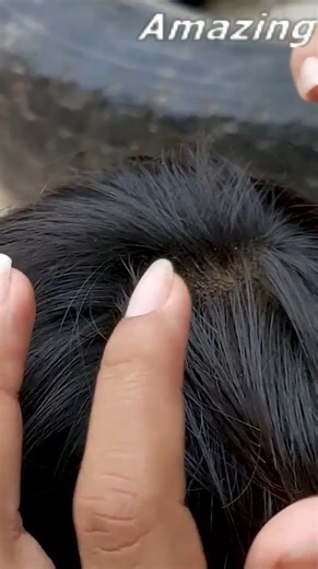Get out all those louse from head Comb a hundred lice from smooth hair | Ggfb