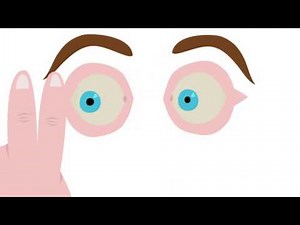 Animation film explaining the working memory theory of EMDR